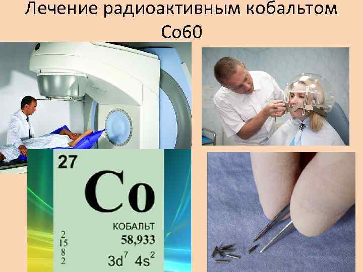 Лечение радиоактивным кобальтом Со 60 