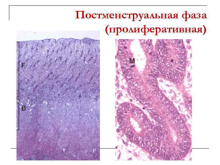 Матка препарат рисунок