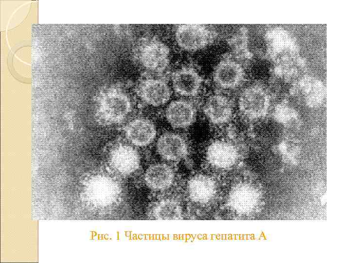 Рис. 1 Частицы вируса гепатита А 