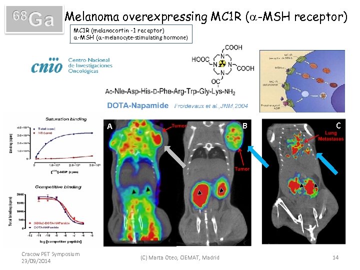 Melanoma overexpressing MC 1 R (a-MSH receptor) MC 1 R (melanocortin -1 receptor) a-MSH