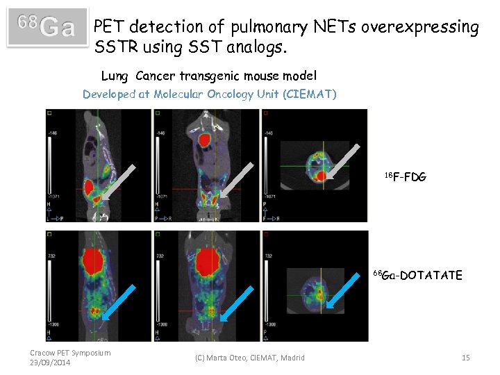 PET detection of pulmonary NETs overexpressing SSTR using SST analogs. Lung Cancer transgenic mouse