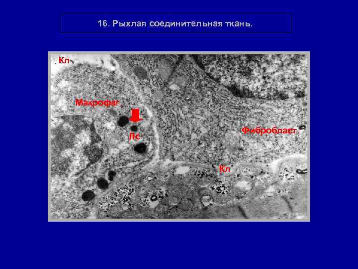 16. Рыхлая соединительная ткань. Кл Макрофаг. Фибробласт. Лс Кл 