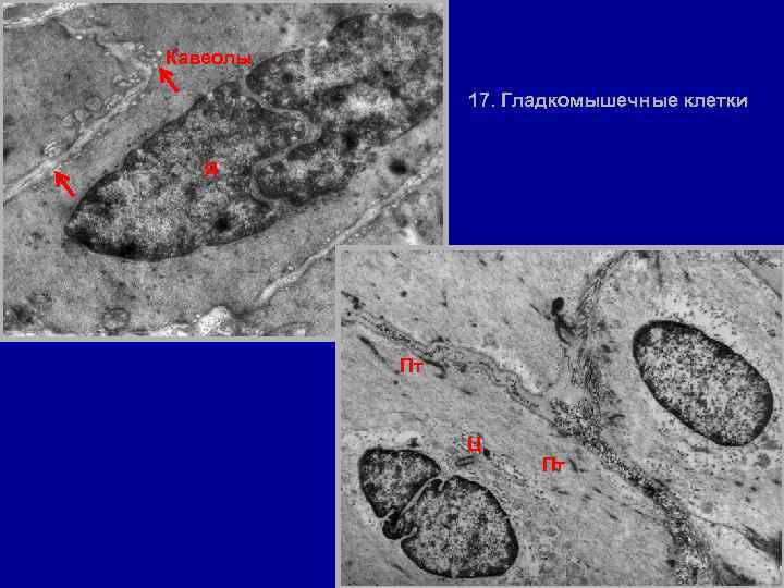 Кавеолы 17. Гладкомышечные клетки Я Пт Ц Пт 