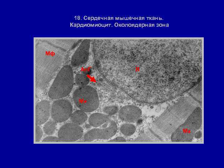 18. Сердечная мышечная ткань. Кардиомиоцит. Околоядерная зона Мф Ап. Г Я Мх Мх 