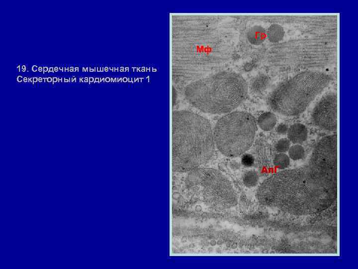 Гр Мф 19. Сердечная мышечная ткань Секреторный кардиомиоцит 1 Ап. Г 