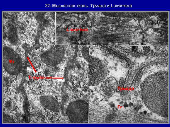 22. Мышечная ткань. Триада и L-система • Мх Т-трубочки Триада Гл 