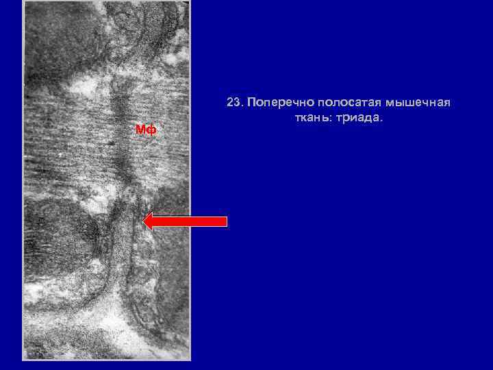 Мф 23. Поперечно полосатая мышечная ткань: триада. 