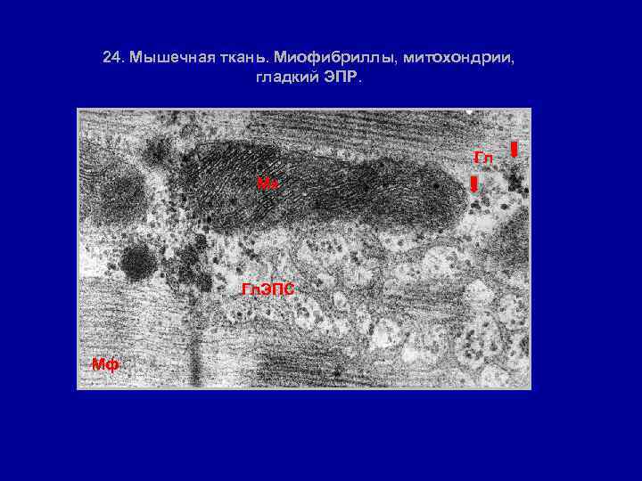24. Мышечная ткань. Миофибриллы, митохондрии, гладкий ЭПР. Гл Мх Гл. ЭПС Мф 