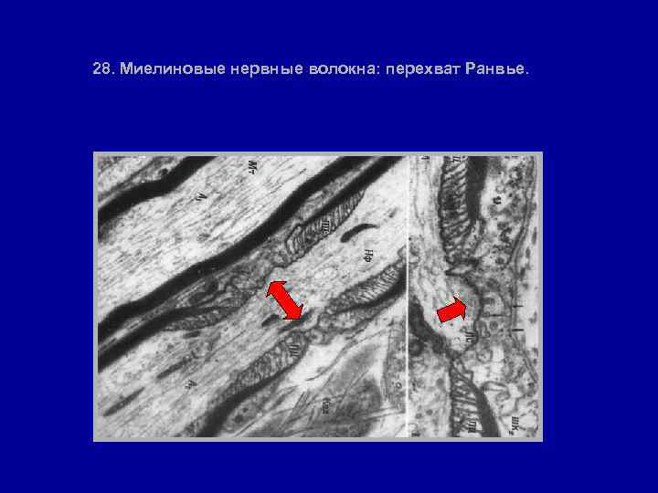 28. Миелиновые нервные волокна: перехват Ранвье. 