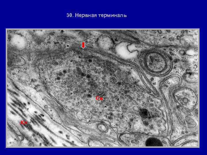 30. Нервная терминаль Св Кл 