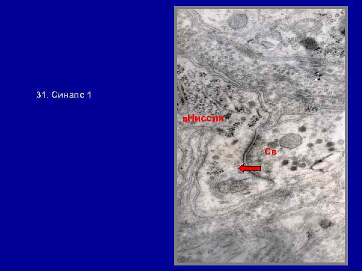 31. Синапс 1 в. Ниссля Св 