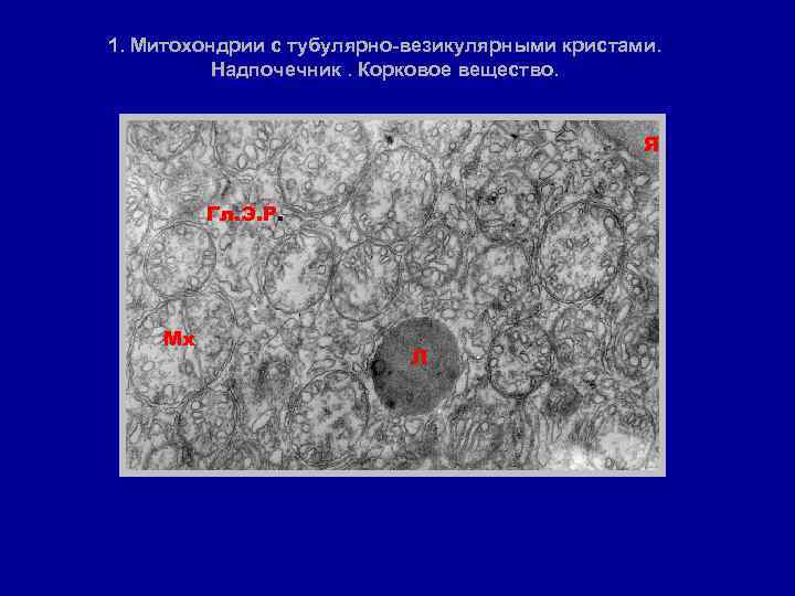 1. Митохондрии с тубулярно-везикулярными кристами. Надпочечник. Корковое вещество. Я Гл. Э. Р. Мх Л