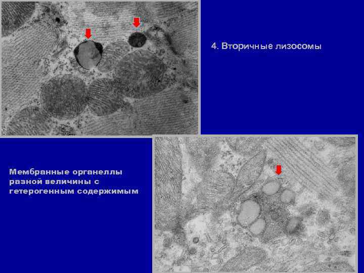 4. Вторичные лизосомы Мембранные органеллы разной величины с гетерогенным содержимым 