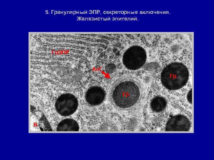 5. Гранулярный ЭПР, секреторные включения. Железистый эпителий. Гр. ЭПР Ап. Г Гр Гр Я