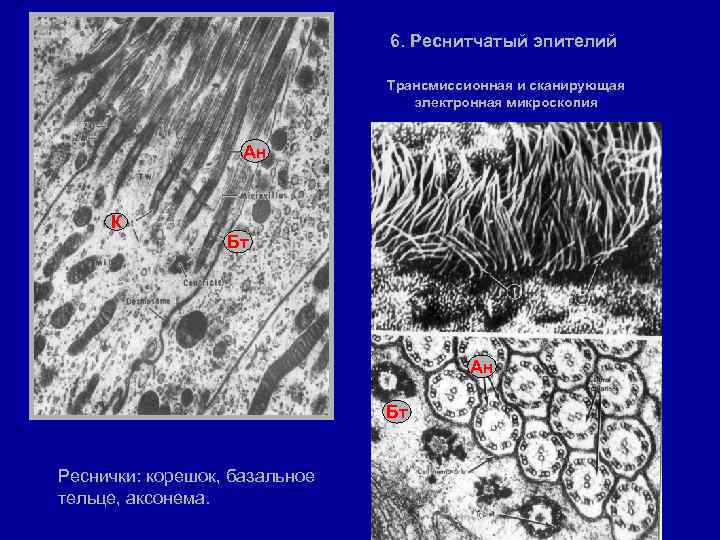 6. Реснитчатый эпителий Трансмиссионная и сканирующая электронная микроскопия Ан К Бт Ан Бт Реснички: