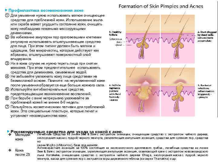 ▶ Профилактика возникновения акне ① Для умывания нужно использовать мягкое очищающее средство для проблемной