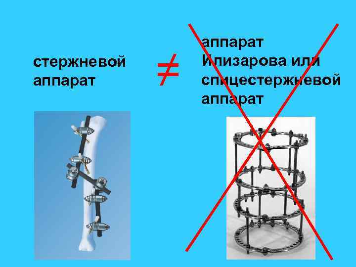 стержневой аппарат ≠ аппарат Илизарова или спицестержневой аппарат 