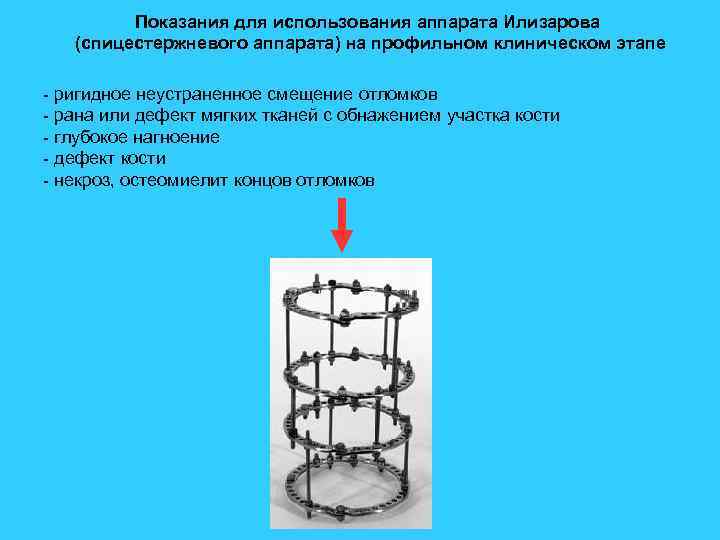 Показания для использования аппарата Илизарова (спицестержневого аппарата) на профильном клиническом этапе - ригидное неустраненное