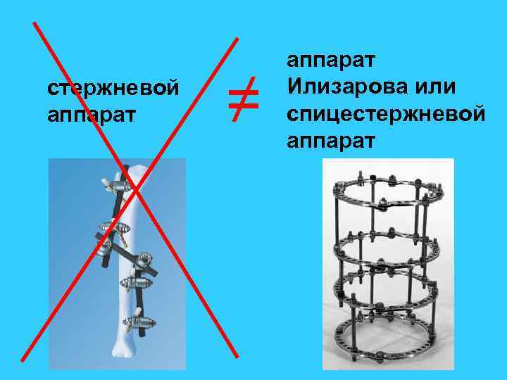 стержневой аппарат ≠ аппарат Илизарова или спицестержневой аппарат 