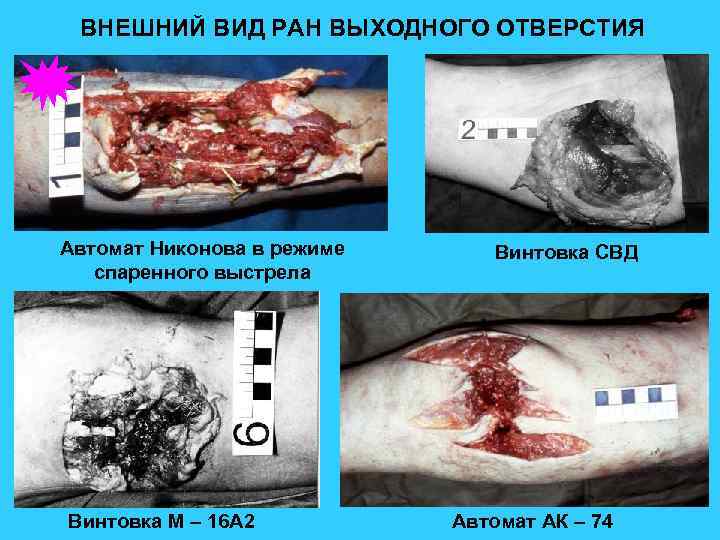 ВНЕШНИЙ ВИД РАН ВЫХОДНОГО ОТВЕРСТИЯ Автомат Никонова в режиме спаренного выстрела Винтовка М –