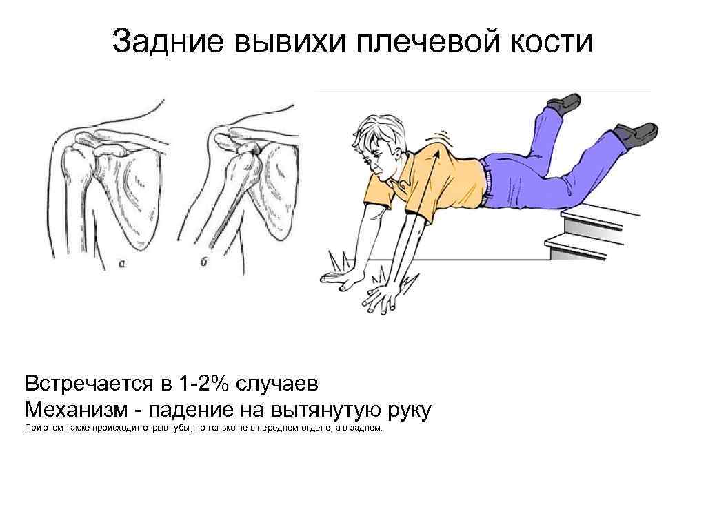 Травмы при падении с высоты презентация