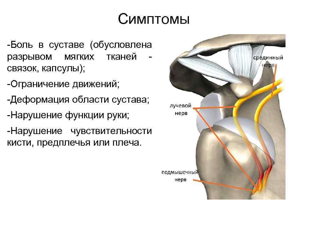 Сустав отзывы. Симптомы повреждения связок плечевого сустава. Травма плечевого сустава разрыв связок. Надрыв плечевой связки симптомы. Разрыв связок плечевого сустава симптомы.