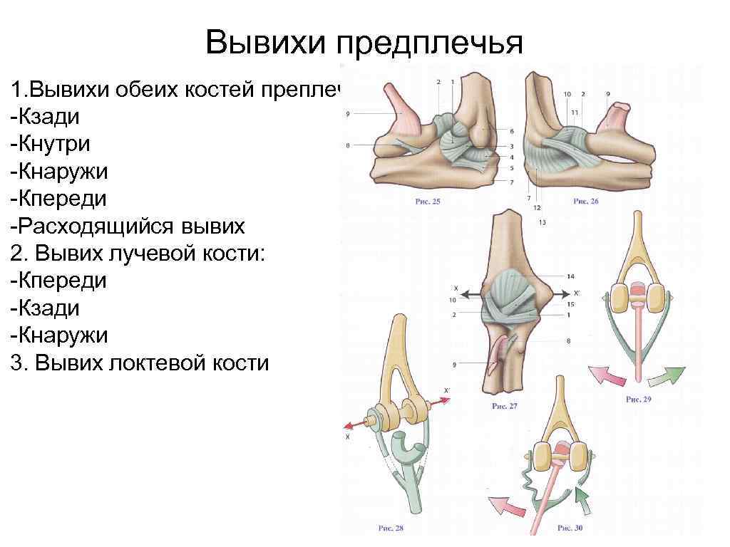 Вывих локтевого сустава карта вызова