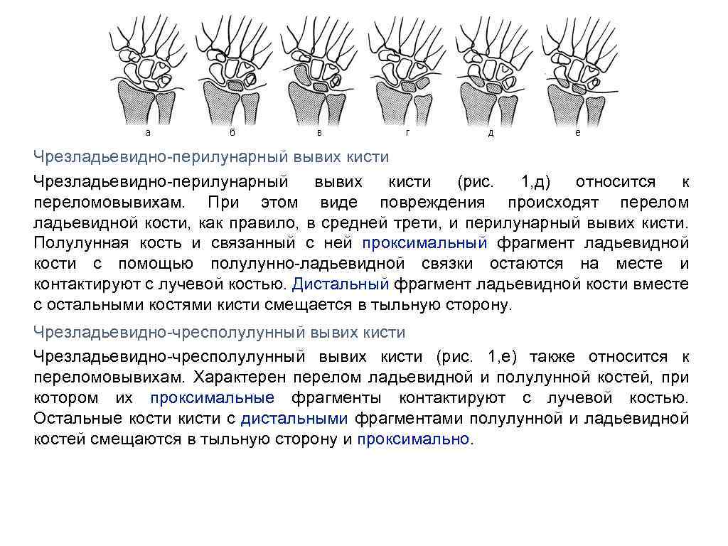 Перелом кисти карта вызова