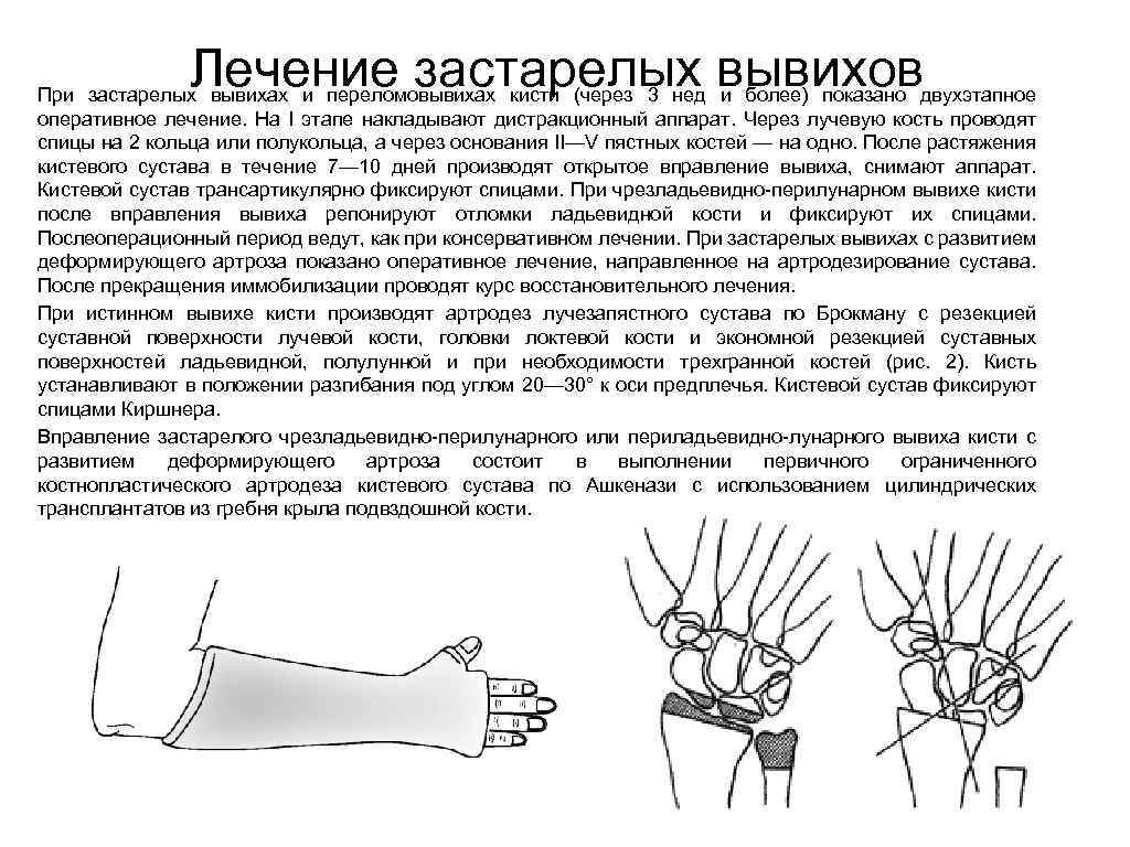 Карта вызова перелом лучезапястного сустава закрытый