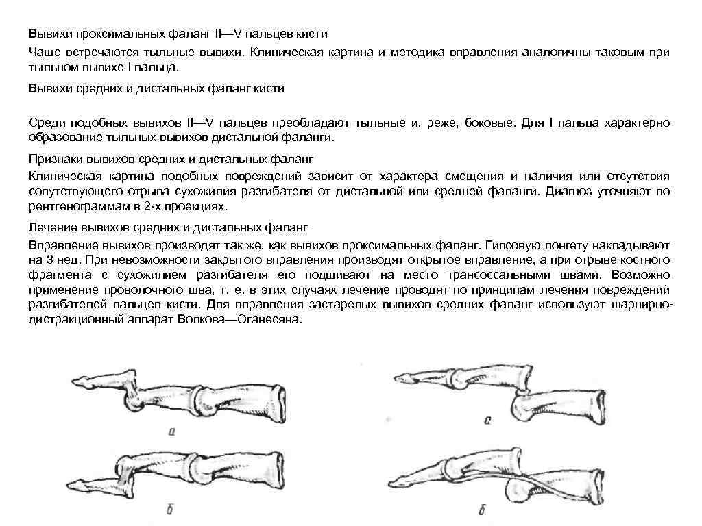 Вывих локтевого сустава карта вызова смп