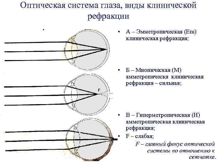 Оптическая система глаза, виды клинической рефракции • А – Эмметропическая (Em) клиническая рефракция; •
