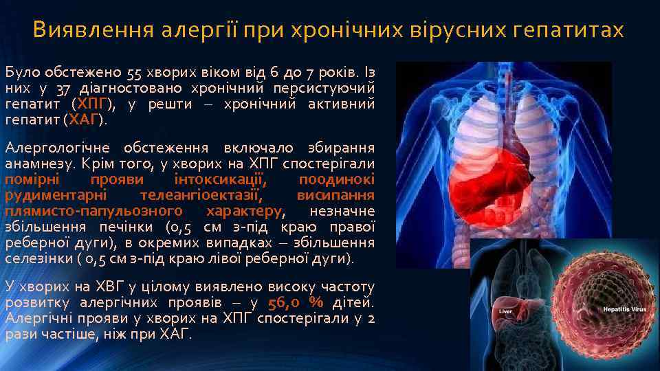 Виявлення алергії при хронічних вірусних гепатитах Було обстежено 55 хворих віком від 6 до