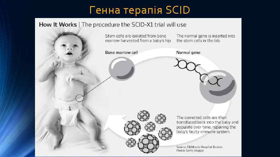 Генна терапія SCID 