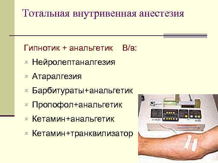 Тотальная внутривенная анестезия Гипнотик + анальгетик В/в: û Нейролептаналгезия û Атаралгезия û Барбитураты+анальгетик û