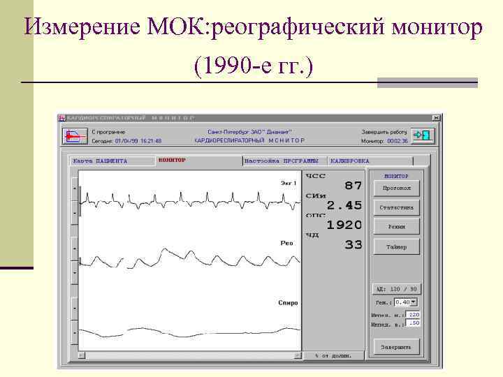 Измерение МОК: реографический монитор (1990 -е гг. ) 