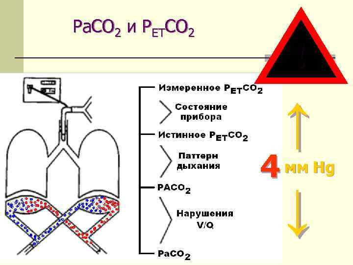 Ра. СО 2 и РЕТСО 2 ! ↑ 4 мм Hg ↓ 