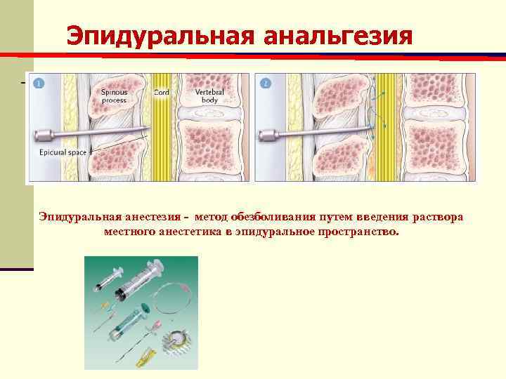 Для местного обезболивания в медицине применяется анестезин который синтезируют по схеме ch3