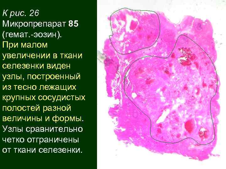 К рис. 26 Микропрепарат 85 (гемат. -эозин). При малом увеличении в ткани селезенки виден