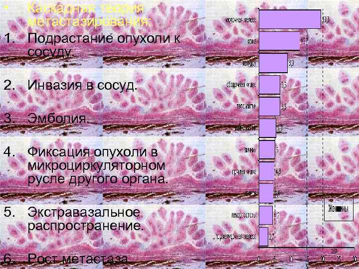  • Каскадная теория метастазирования: 1. Подрастание опухоли к сосуду. 2. Инвазия в сосуд.
