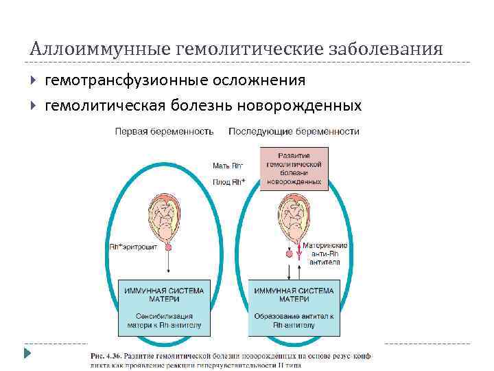Аллоиммунные гемолитические заболевания гемотрансфузионные осложнения гемолитическая болезнь новорожденных 