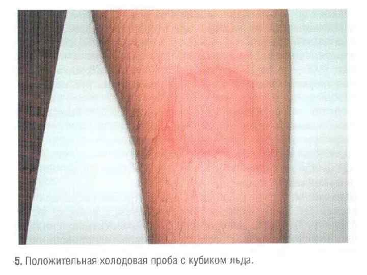 3) Провокационные тесты Методы диагностики, основанные га реакциях, ктр возникают при контакте шокового органа