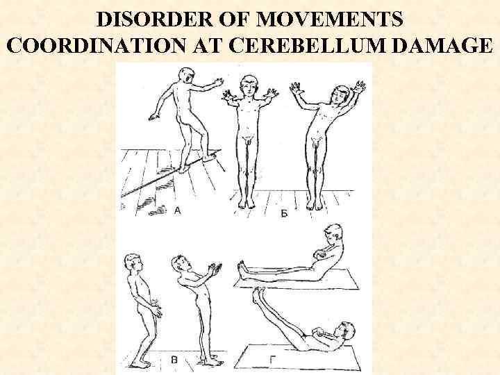 DISORDER OF MOVEMENTS COORDINATION AT CEREBELLUM DAMAGE 