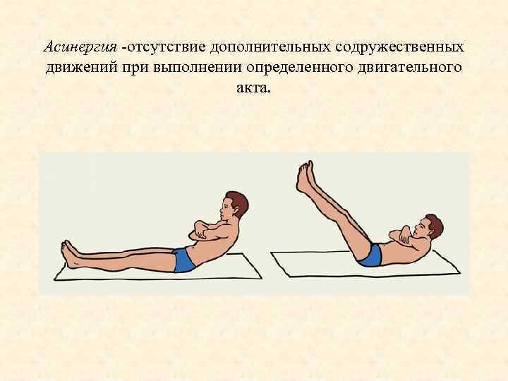 Асинергия отсутствие дополнительных содружественных движений при выполнении определенного двигательного акта. 