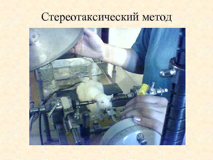 Стереотаксический метод 