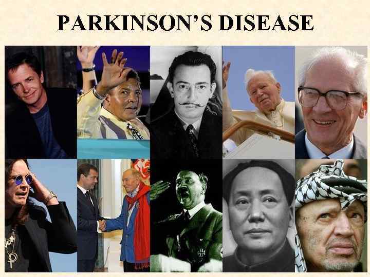PARKINSON’S DISEASE 