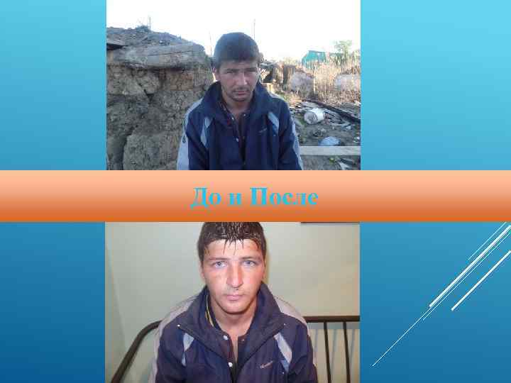 До и После 
