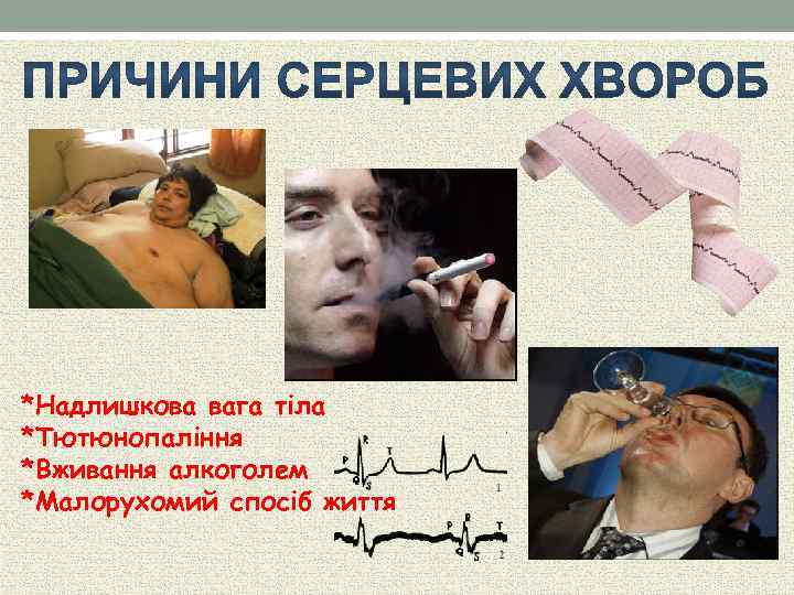 *Надлишкова вага тіла *Тютюнопаління *Вживання алкоголем *Малорухомий спосіб життя 