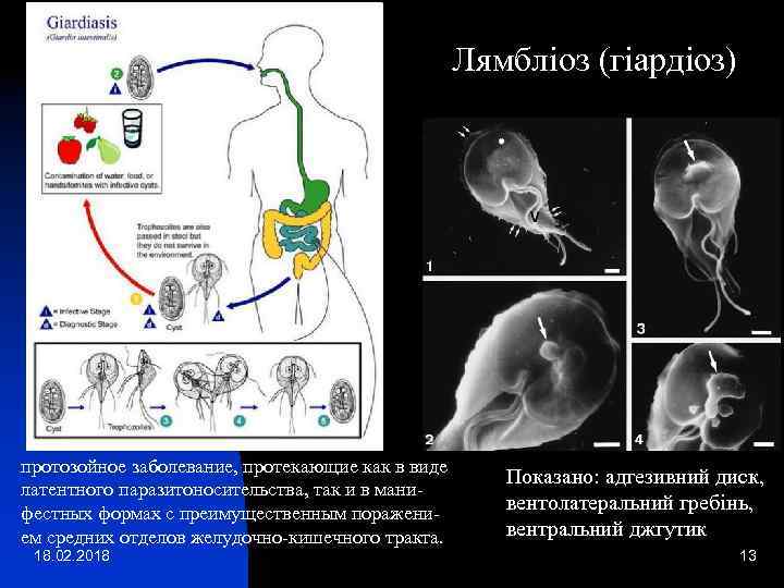 Лямбліоз (гіардіоз) протозойное заболевание, протекающие как в виде латентного паразитоносительства, так и в манифестных