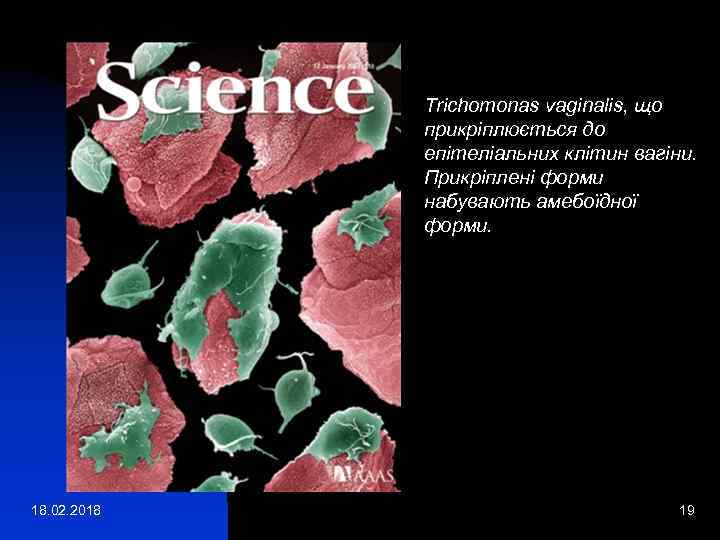 Trichomonas vaginalis, що прикріплюється до епітеліальних клітин вагіни. Прикріплені форми набувають амебоїдної форми. 18.