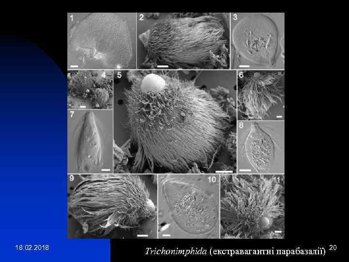 18. 02. 2018 Trichonimphida (екстравагантні парабазалії) 20 